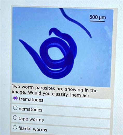 Megalodiscus! Un Gusano Trematode Que Te Dejará con la Boca Abierta