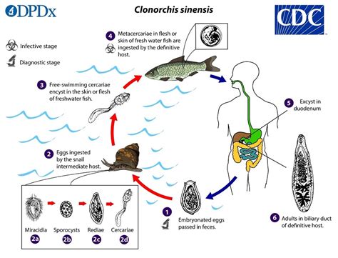  Clonorchis Sinensis: Un gusano trematodo que ama los peces y se aloja en el hígado humano