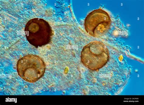  Quadrulella: ¿Un Amoebozo con Cuatro Brazos para Abrazar el Mundo Microscópico?