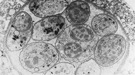  Toxoplasma gondii: ¡Un parásito escurridizo que manipula mentes y cruza continentes!