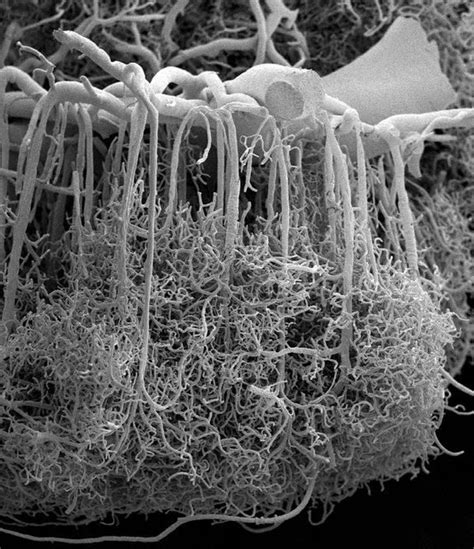  Xiphysuvorax! Una Maravilla Microscópica que Te Hará Reevaluar la Definición de Bestia